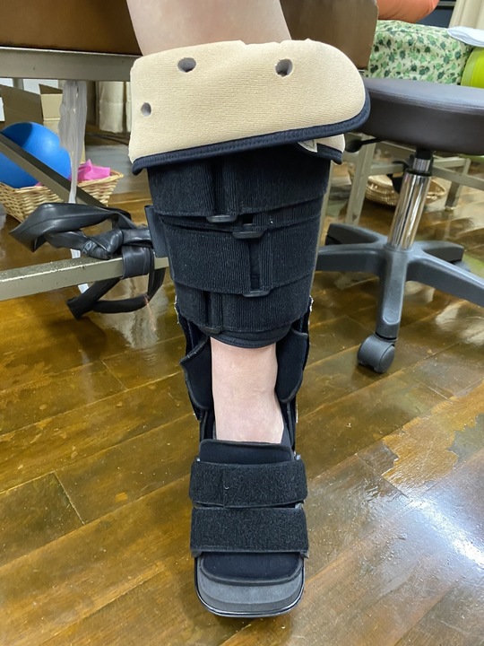 バドミントンで受傷した新鮮アキレス腱断裂の保存療法（愛知県