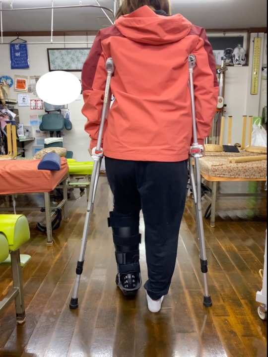 永田接骨院で行うアキレス腱断裂の保存療法について-永田接骨院 - 豊田