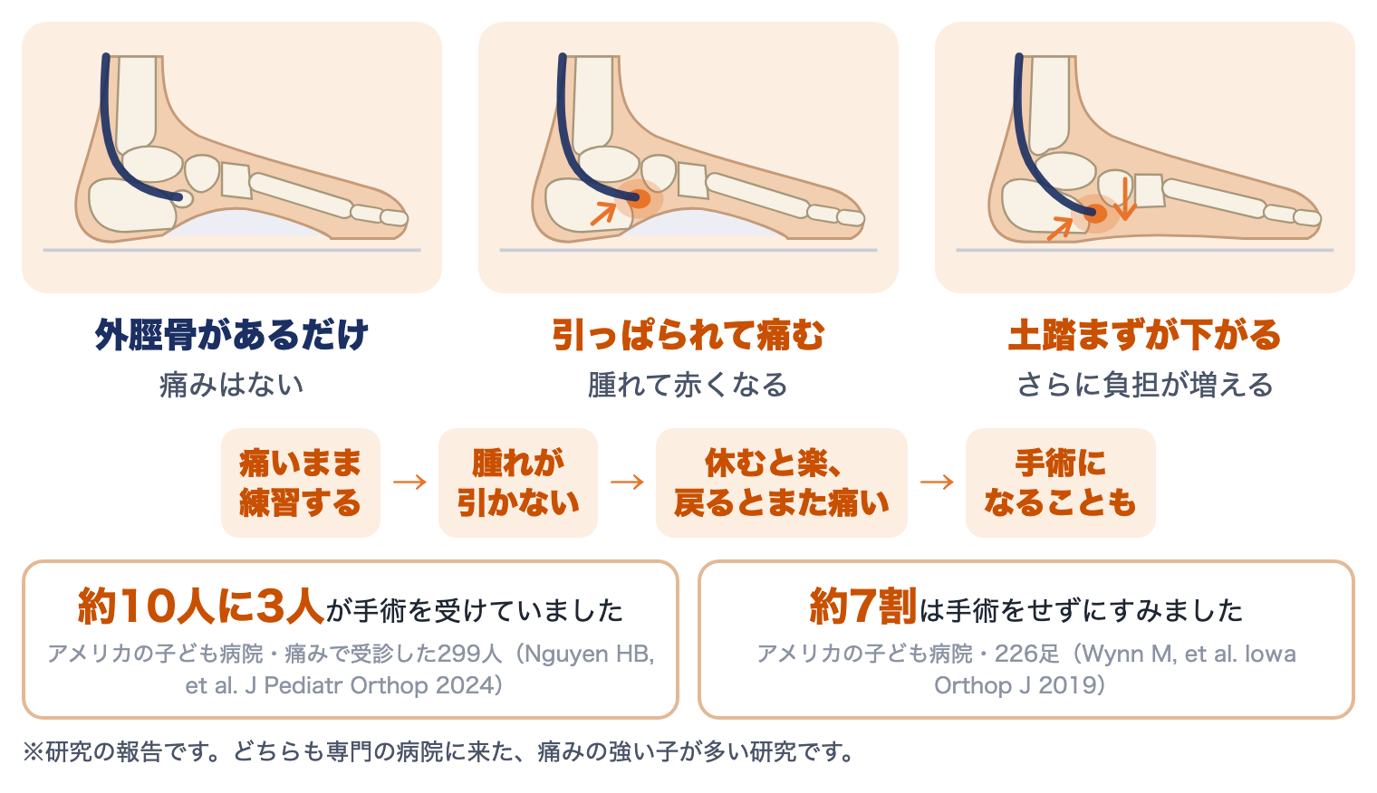有痛性外脛骨を放っておくと：外脛骨があるだけ、腱に引っぱられて痛む、土踏まずが下がるの3つの絵と、痛いまま練習する・腫れが引かない・休むと楽で戻るとまた痛い・手術になることもという流れ、約10人に3人が手術・約7割は手術をせずにすんだという研究