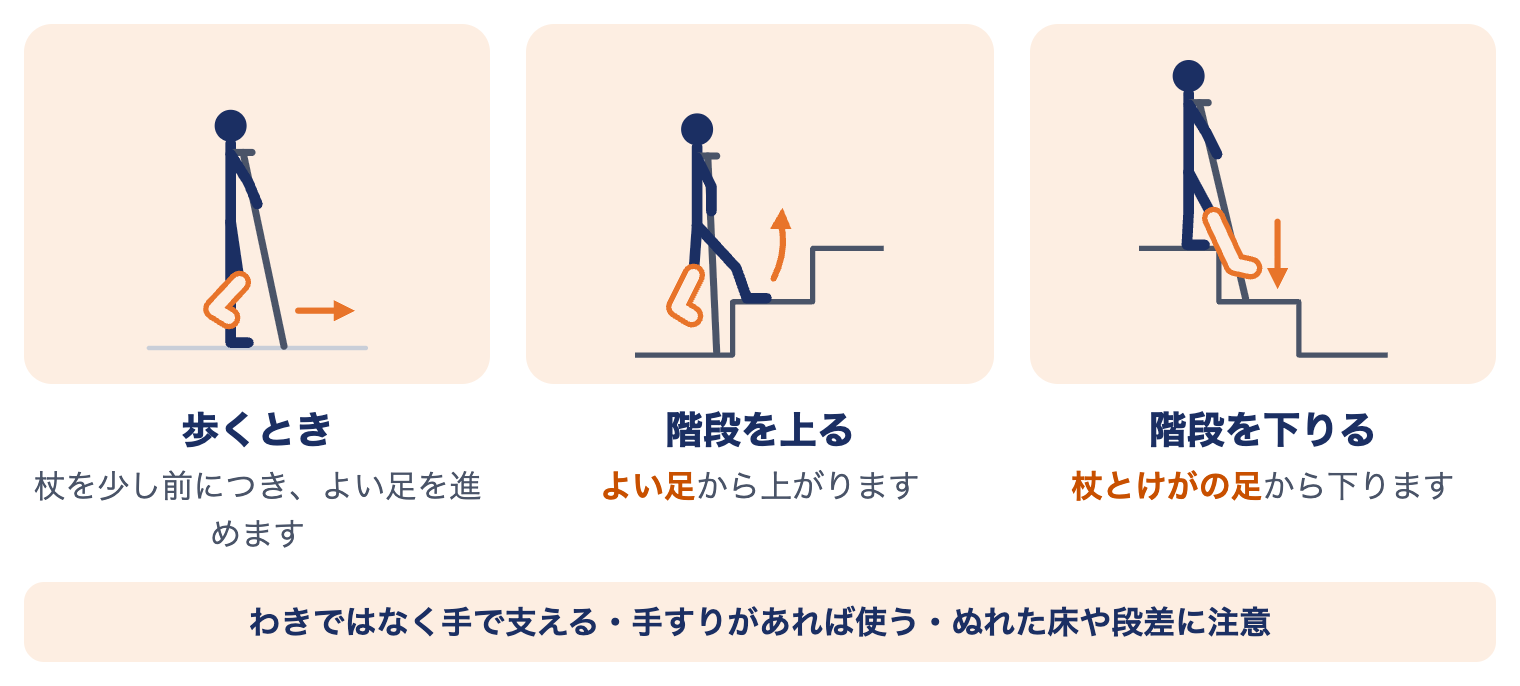 外果骨折の松葉杖の使い方：歩くときは杖を少し前につきよい足を進める、階段は上りはよい足から、下りは杖とけがの足から