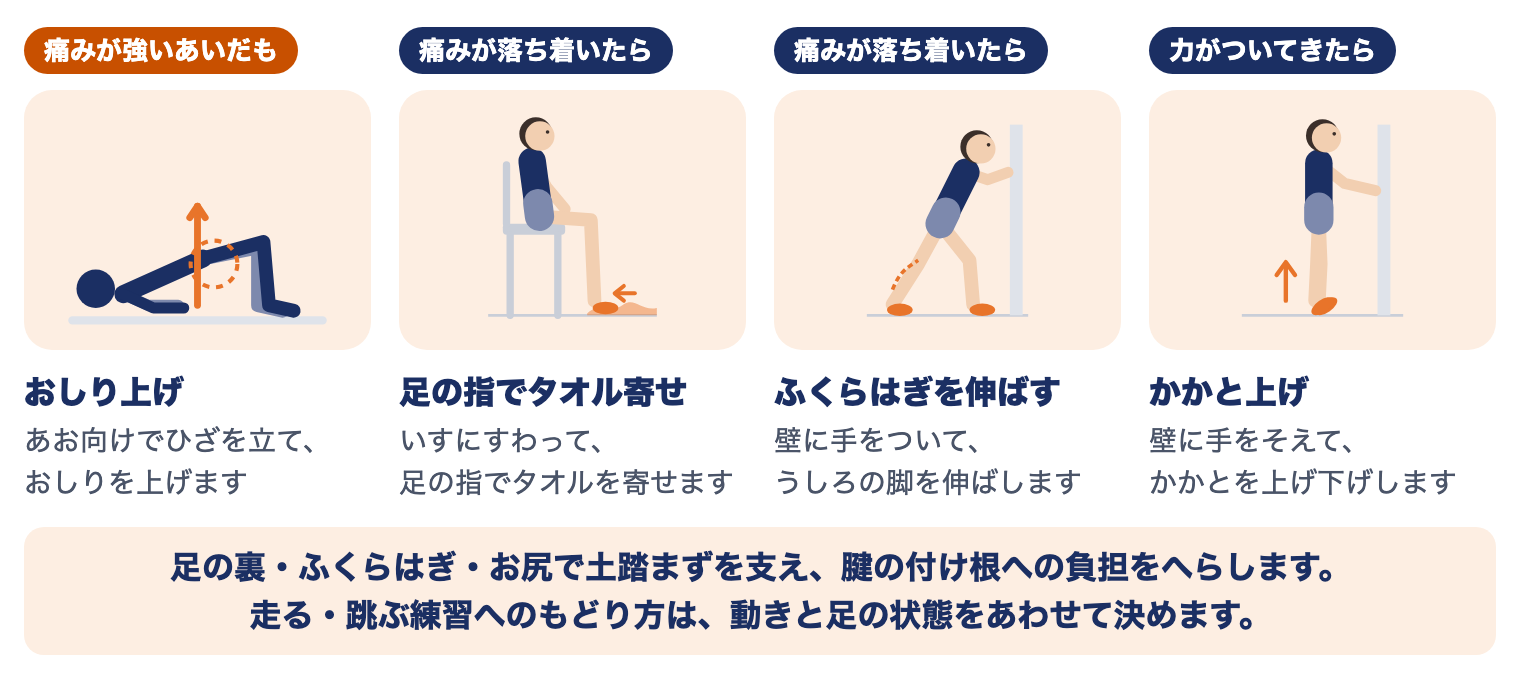 有痛性外脛骨の運動療法（時期別）：痛みが強いあいだはおしり上げ、痛みが落ち着いたら足の指でタオル寄せ・ふくらはぎを伸ばす、力がついてきたらかかと上げ