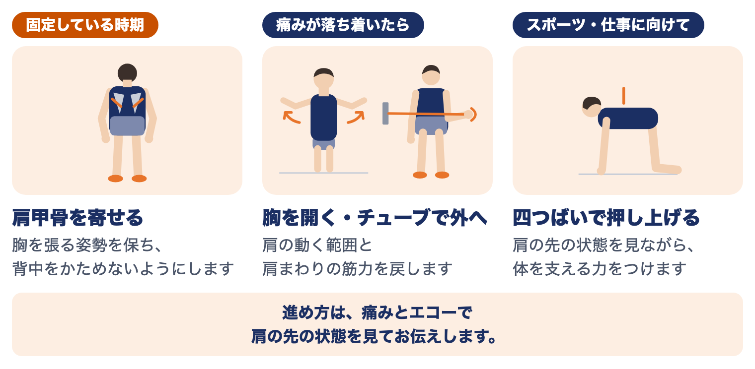 肩鎖関節脱臼の時期別の運動療法：固定している時期は肩甲骨を寄せる、痛みが落ち着いたら胸を開く・チューブで外へ、スポーツ・仕事に向けて四つばいで押し上げる