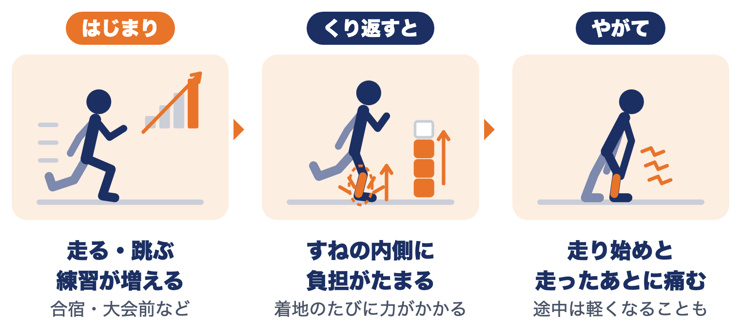 シンスプリントが起きる流れ：練習が増える→すねの内側に負担がたまる→走り始めと走ったあとに痛む