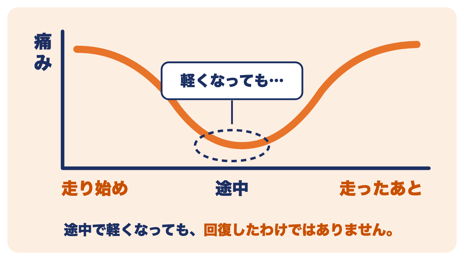 シンスプリントの痛みの出かた：走り始めと走ったあとに痛み、途中で軽くなっても回復したわけではない