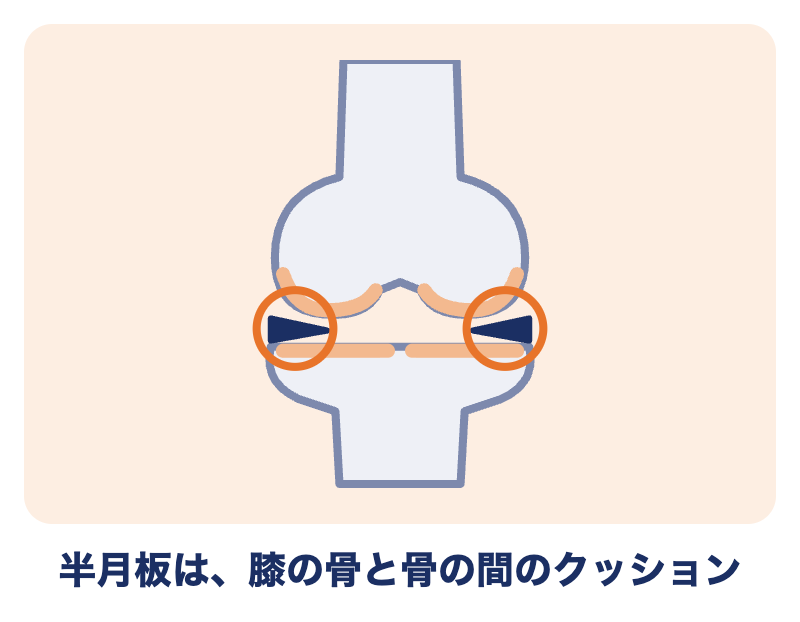 半月板は、膝の骨と骨の間にあるクッション