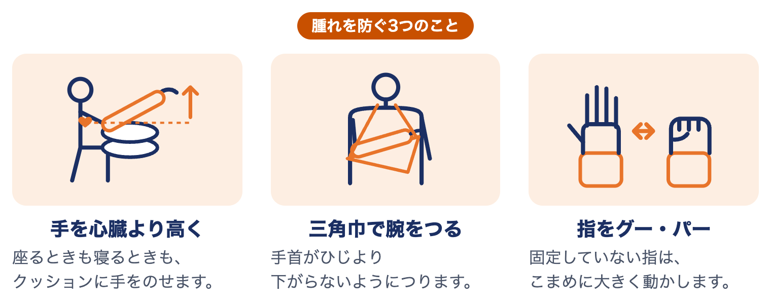 コーレス骨折の固定中に腫れを防ぐ3つのこと：手を心臓より高く、三角巾で腕をつる、指をグー・パー