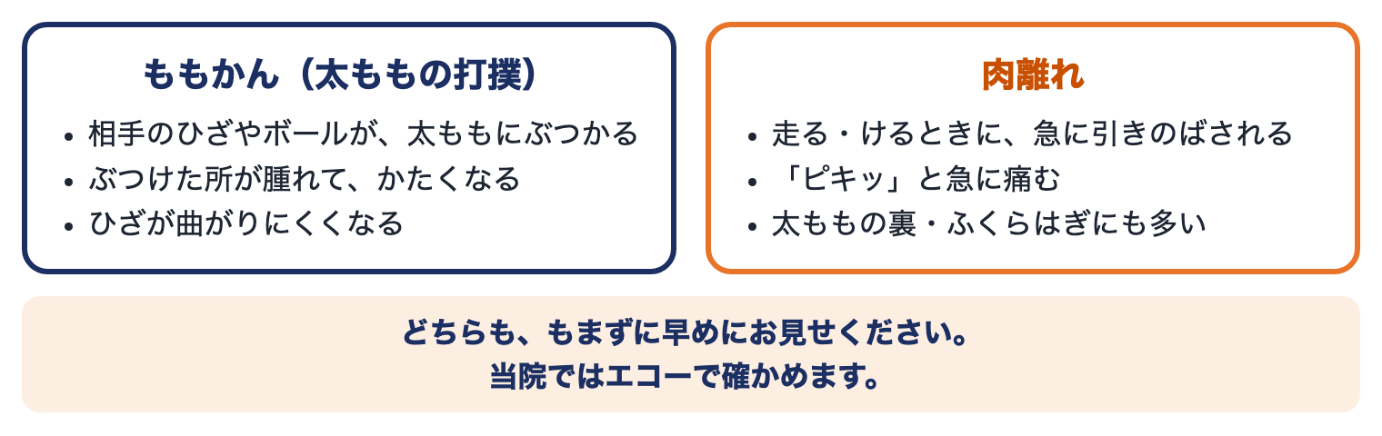 大腿部打撲（ももかん）と肉離れのちがい：ももかんは相手のひざやボールがぶつかり腫れてかたくなる、肉離れは走る・けるときに急に引きのばされ「ピキッ」と痛む