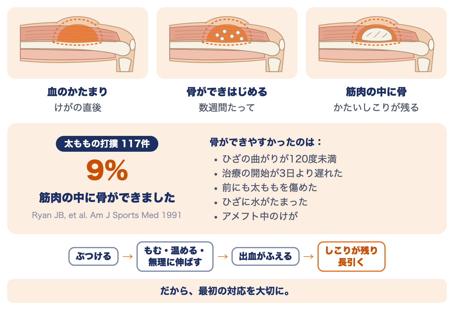 大腿部打撲（ももかん）が長引くしくみ：血のかたまりから数週間で骨ができはじめ、筋肉の中にかたいしこりが残る。研究では9％に骨ができ、治療開始の遅れなどが関係していた