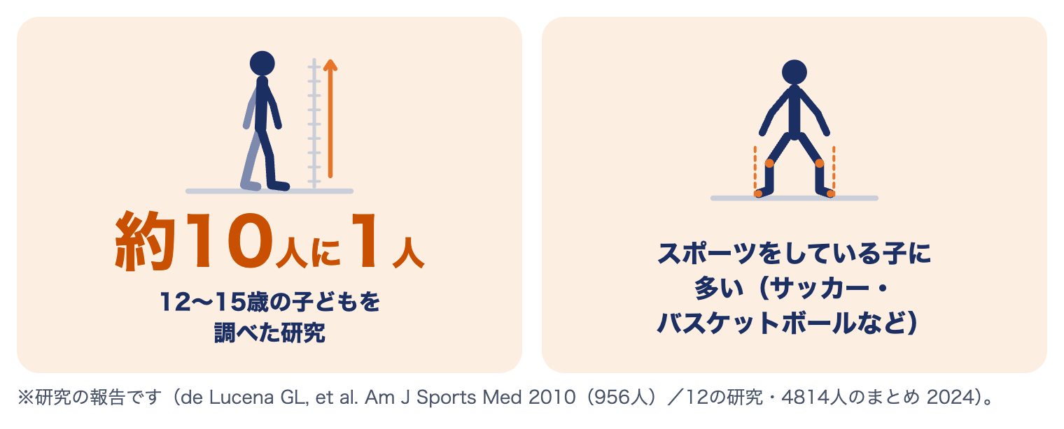 オスグッド病は12〜15歳の約10人に1人にみられ、スポーツをしている子に多い（研究の報告）
