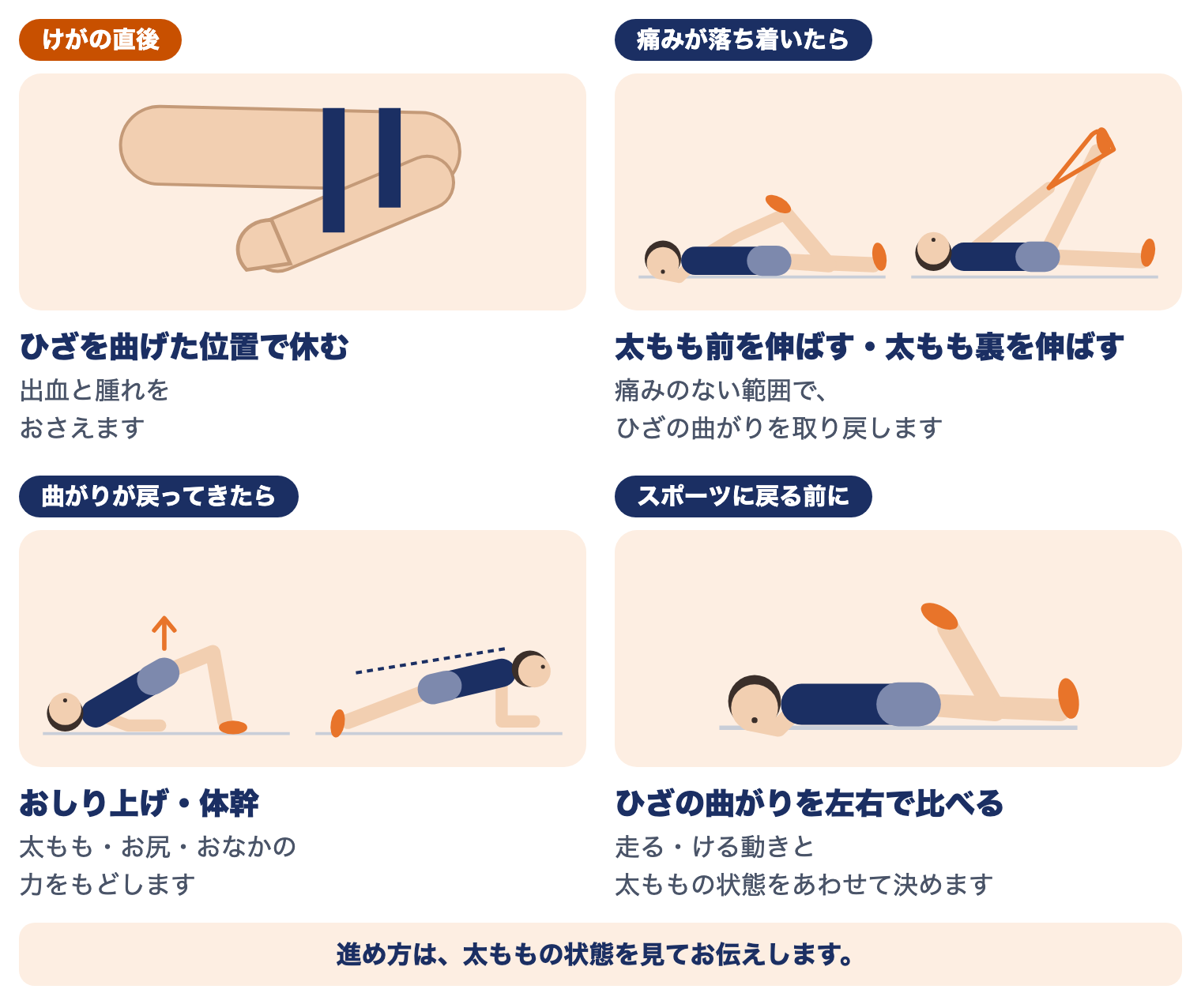 大腿部打撲（ももかん）の時期別の運動療法：けがの直後はひざを曲げた位置で休む、痛みが落ち着いたら太もも前・裏を伸ばす、曲がりが戻ってきたらおしり上げ・体幹、スポーツに戻る前にひざの曲がりを左右で比べる