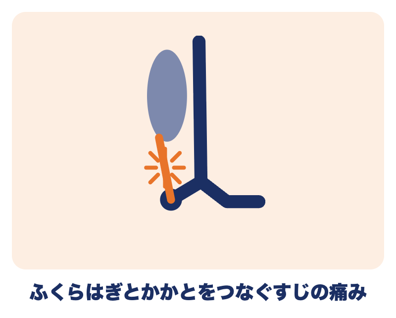 アキレス腱損傷のよくあるご質問：ふくらはぎとかかとをつなぐアキレス腱の痛み