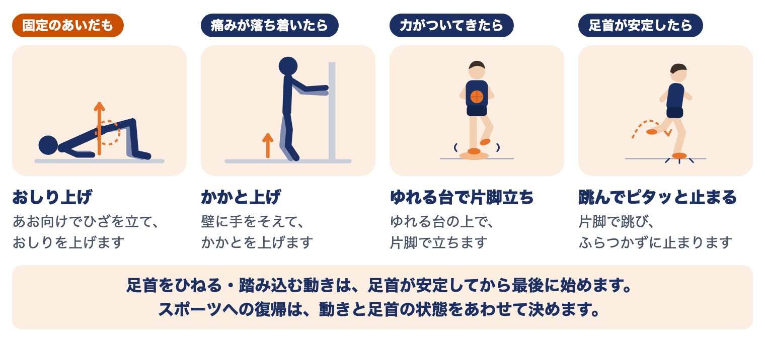 前脛腓靱帯損傷の運動療法（時期別）：固定のあいだはおしり上げ、痛みが落ち着いたらかかと上げ、力がついてきたらゆれる台の上で片脚立ち、足首が安定したら片脚で跳んでピタッと止まる