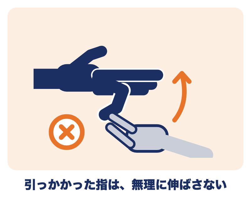 ばね指で引っかかった指を、反対の手で無理に伸ばさないでくださいという図
