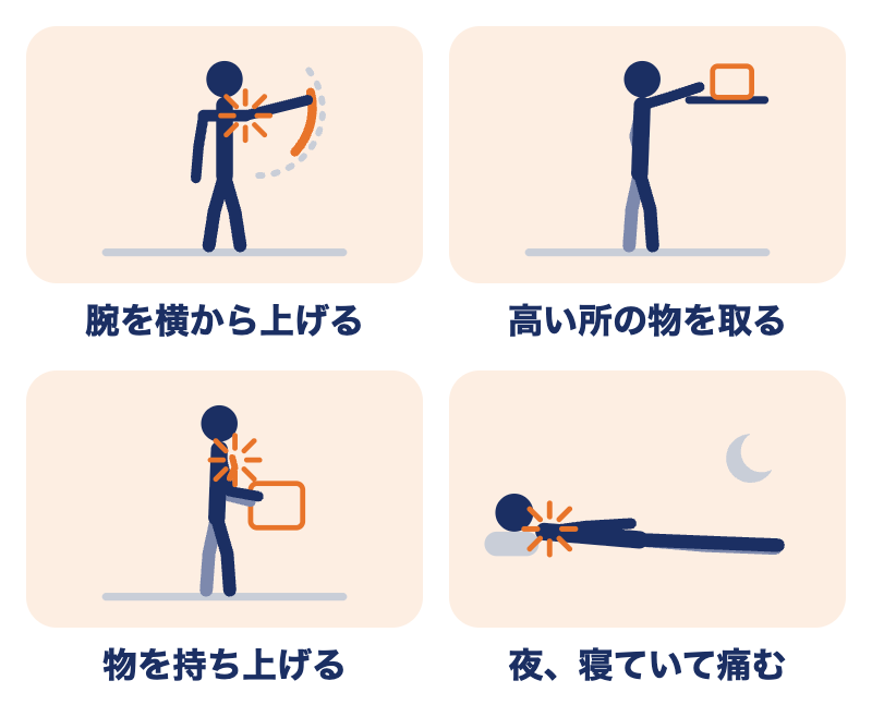 腱板損傷で痛みやすい動き：腕を横から上げる、高い所の物を取る、物を持ち上げる、夜寝ていて痛む