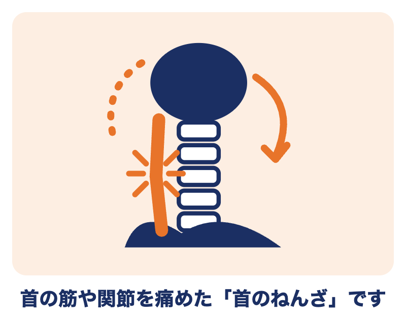 むち打ちとは：首の筋や関節を痛めた首のねんざ