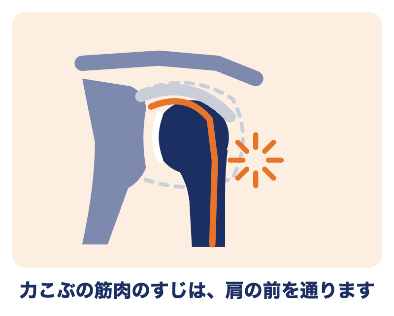 上腕二頭筋長頭腱とは：力こぶの筋肉のすじで、肩の前を通る