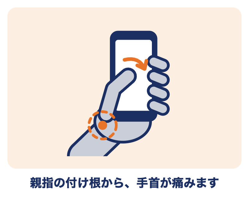 ドケルバン病：スマホを片手で持つ手。親指の付け根から手首の親指側が痛む
