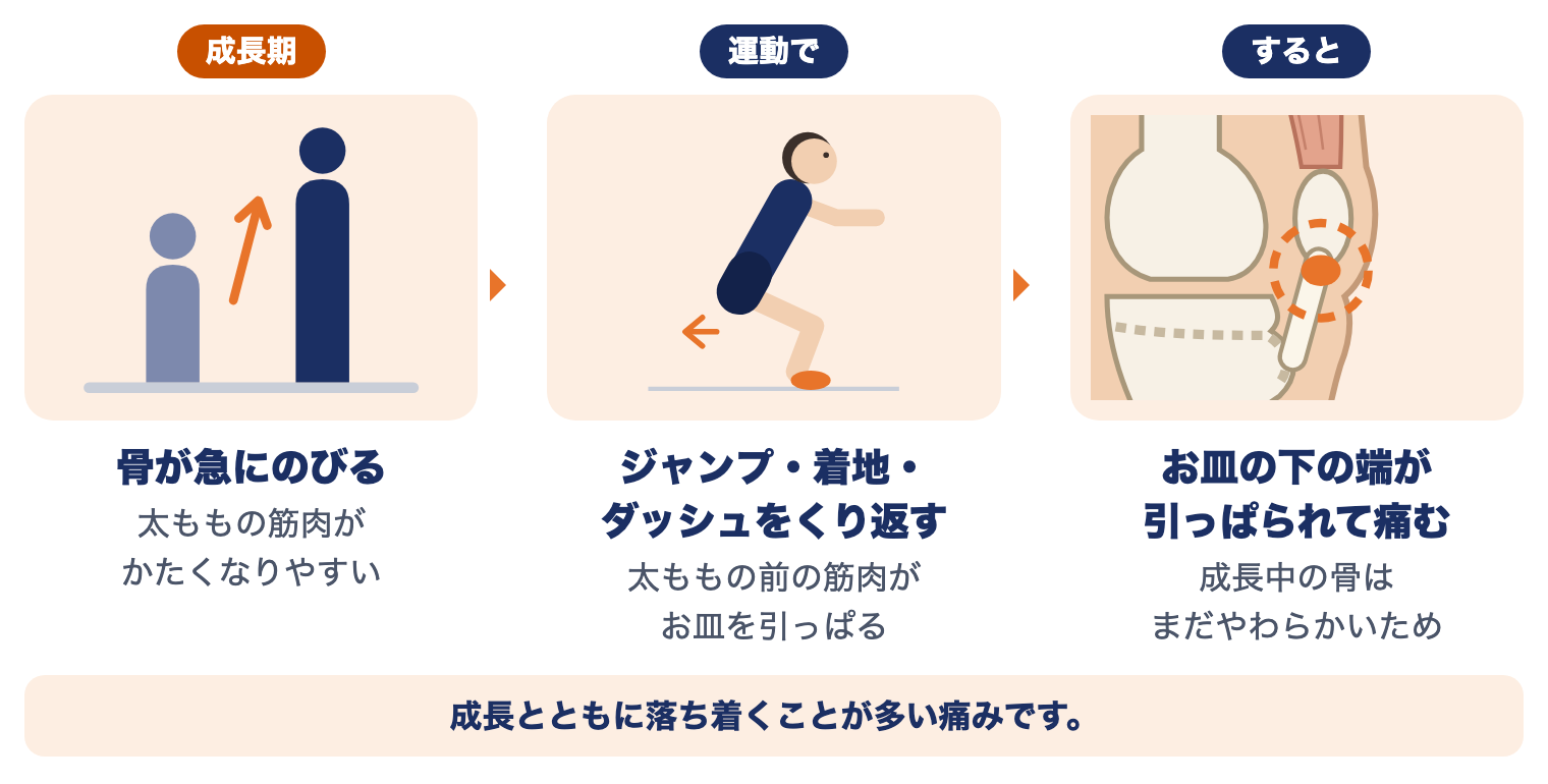シンディング・ラーセン・ヨハンソン病の起こり方：成長期に骨が急にのび、ジャンプや着地をくり返すと、お皿の下の端が引っぱられて痛む