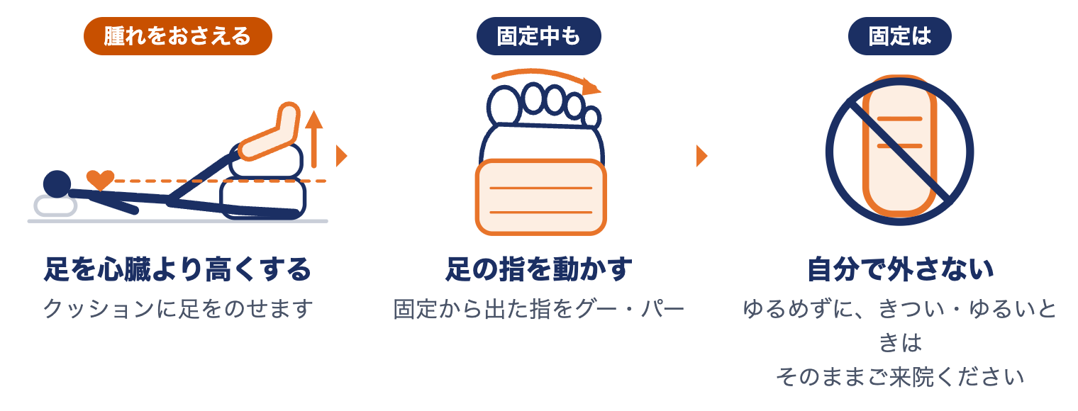 外果骨折でまずしてほしいこと：足を心臓より高くする、固定中も足の指を動かす、固定は自分で外さない