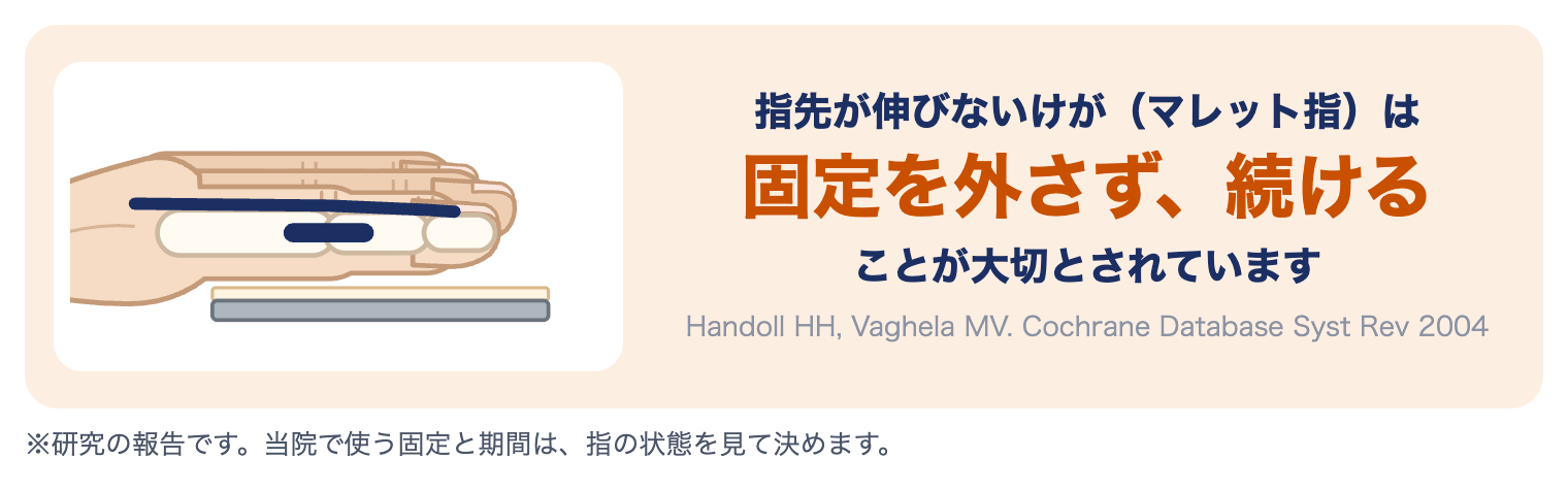 突き指（マレット指）の研究：指先が伸びないけがは、固定を外さず続けることが大切とされています（Handoll 2004）