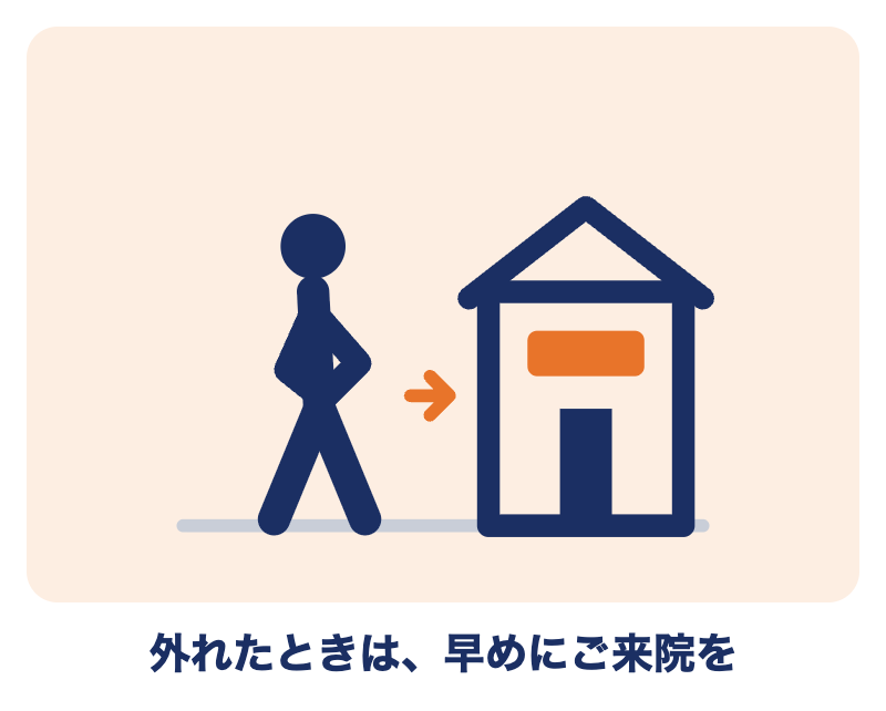 肩が外れたときは、無理に戻さず早めに永田接骨院へご来院を