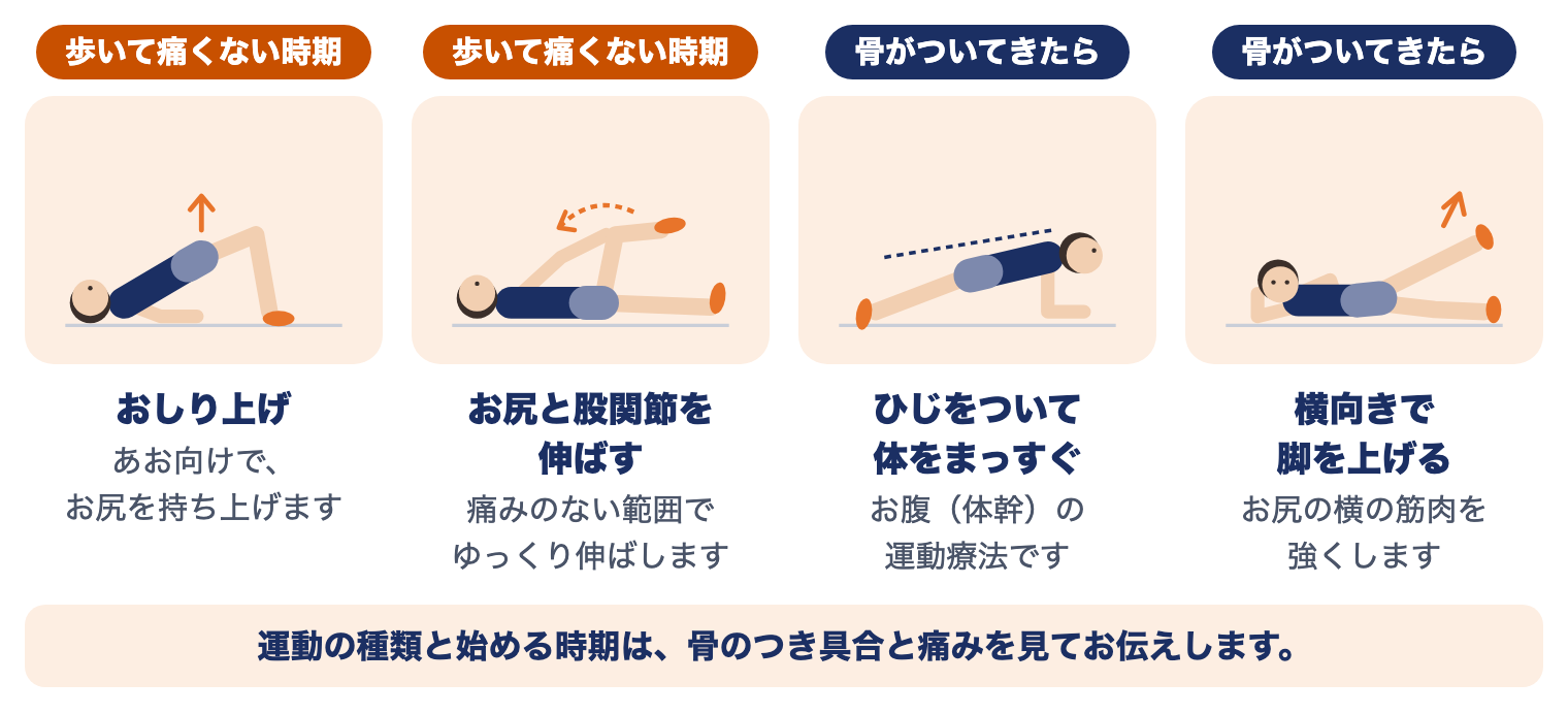 恥骨・坐骨の疲労骨折の運動療法（時期別）：歩いて痛くない時期はおしり上げ・お尻と股関節を伸ばす、骨がついてきたらひじをついて体をまっすぐ・横向きで脚を上げる