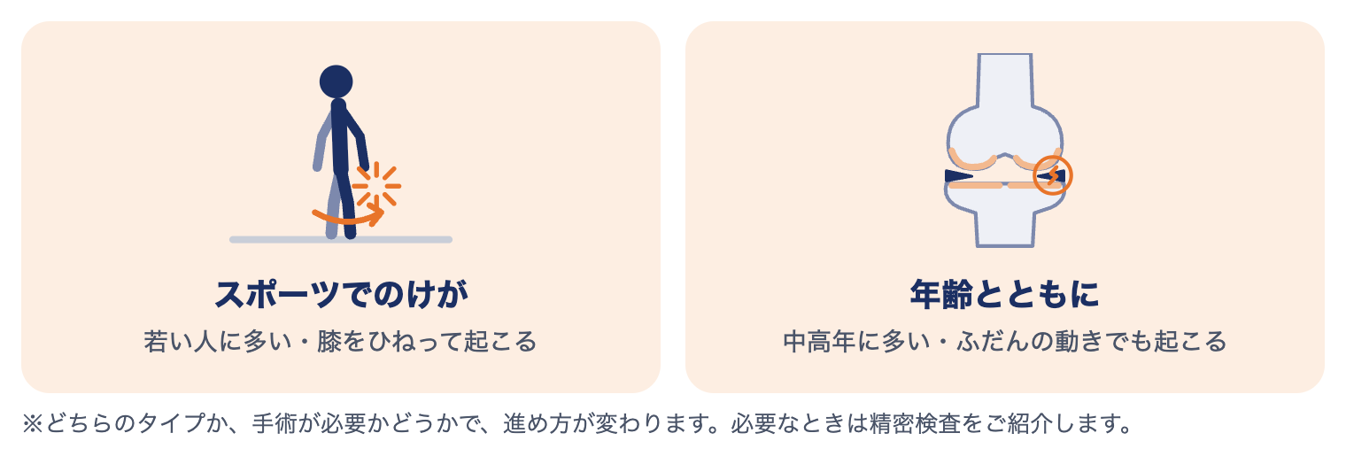 半月板損傷の2つのタイプ：若い人に多いスポーツでのけがと、中高年に多い年齢とともに起こるもの