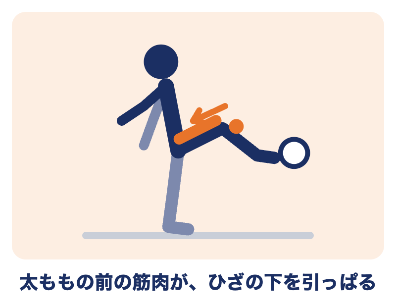オスグッド病は、太ももの前の筋肉がひざの下の出っぱりを引っぱって痛む（成長痛とのちがい）