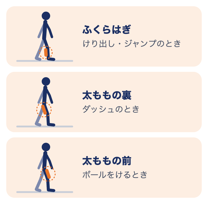 肉離れが起きやすい場所と場面：ふくらはぎはけり出し・ジャンプ、太ももの裏はダッシュ、太ももの前はボールをけるとき