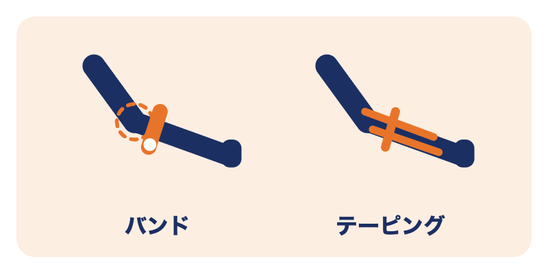 テニス肘の施術で使う固定：肘のバンドとテーピング
