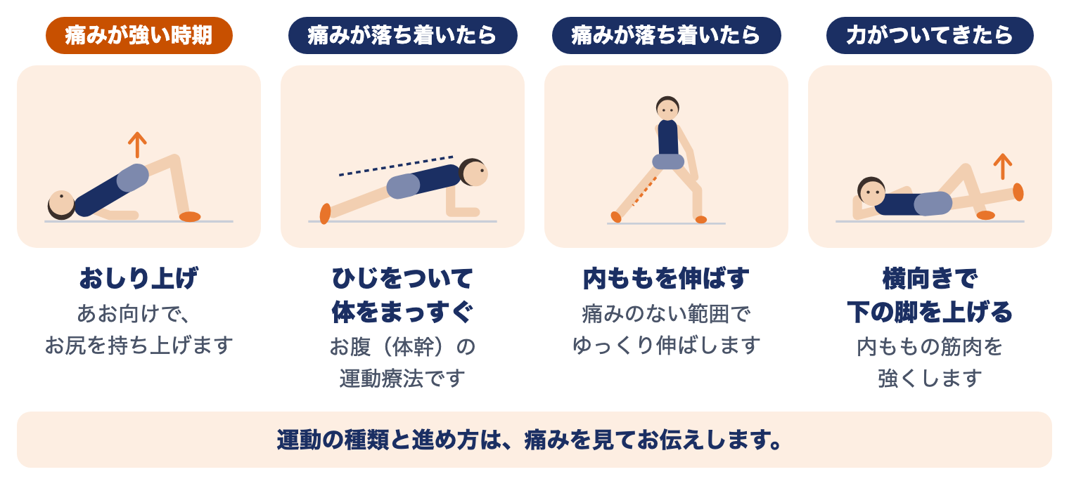 グローインペイン症候群の運動療法（時期別）：痛みが強い時期はおしり上げ、落ち着いたらひじをついて体をまっすぐ・内ももを伸ばす、力がついてきたら横向きで下の脚を上げる