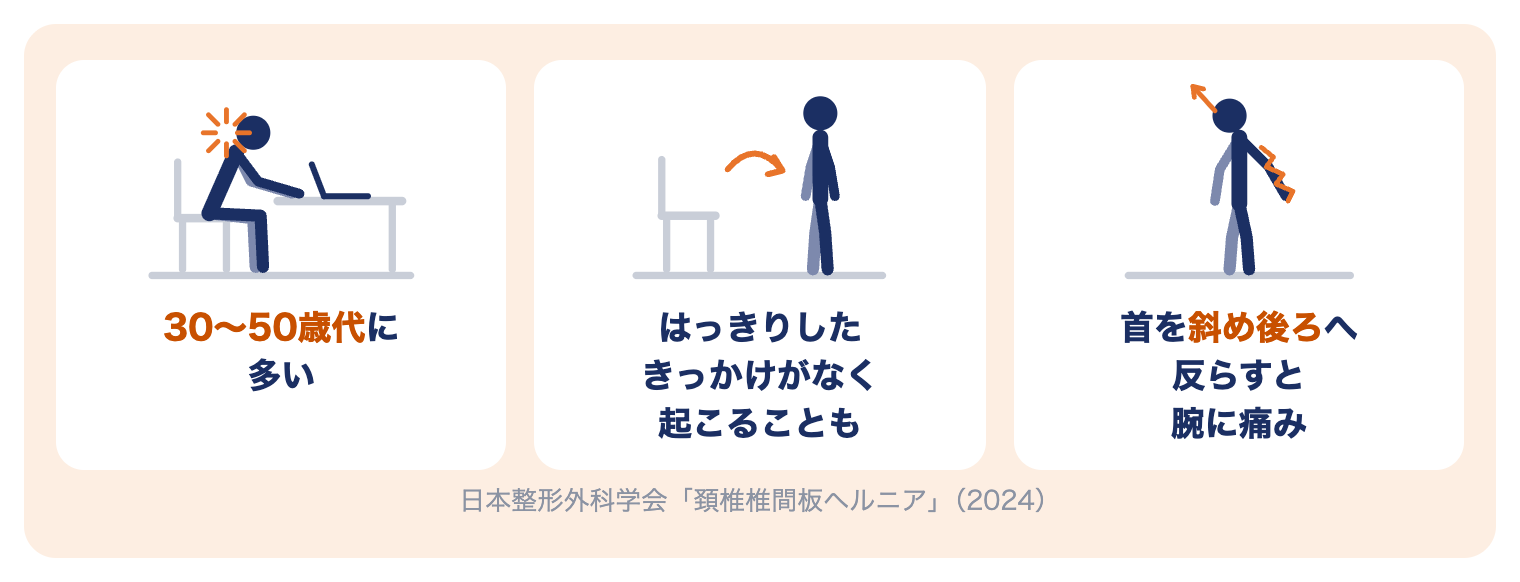 頚椎ヘルニアの特徴：30〜50歳代に多い、きっかけなく起こることも、首を斜め後ろへ反らすと腕に痛み（日本整形外科学会）