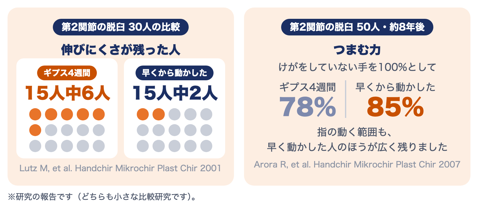 指の脱臼の研究：ギプス4週間では15人中6人、早くから動かすと15人中2人に伸びにくさ。約8年後のつまむ力は78%と85%