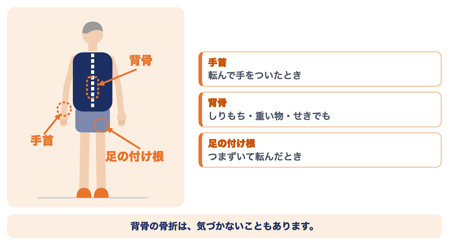 骨粗しょう症で折れやすい3か所：手首（転んで手をついたとき）・背骨（しりもち・重い物・せきでも）・足の付け根（つまずいて転んだとき）