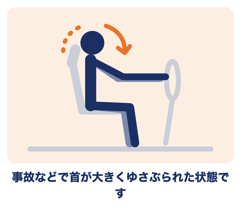 むち打ちとは：事故などで首が大きくゆさぶられた状態