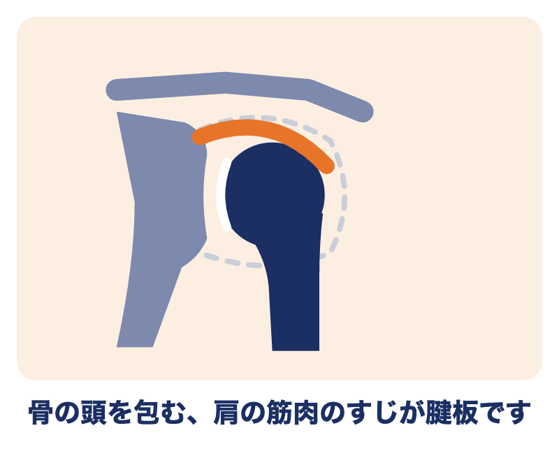 腱板とは：肩の骨の頭を包む、肩の筋肉のすじ
