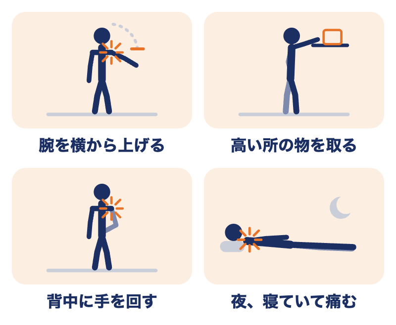 五十肩で痛みやすい動き：腕を横から上げる、高い所の物を取る、背中に手を回す、夜寝ていて痛む