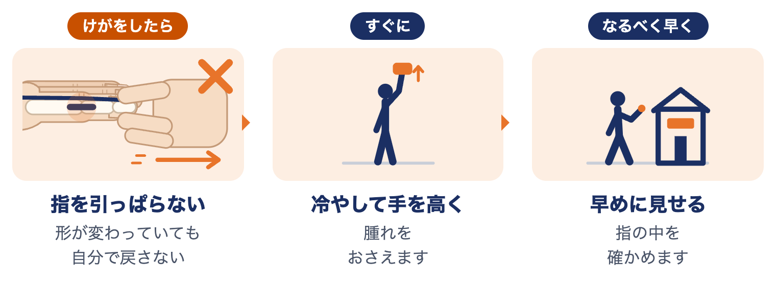 突き指をしたときにしてほしいこと：指を引っぱらない、冷やして手を高く、早めに見せる
