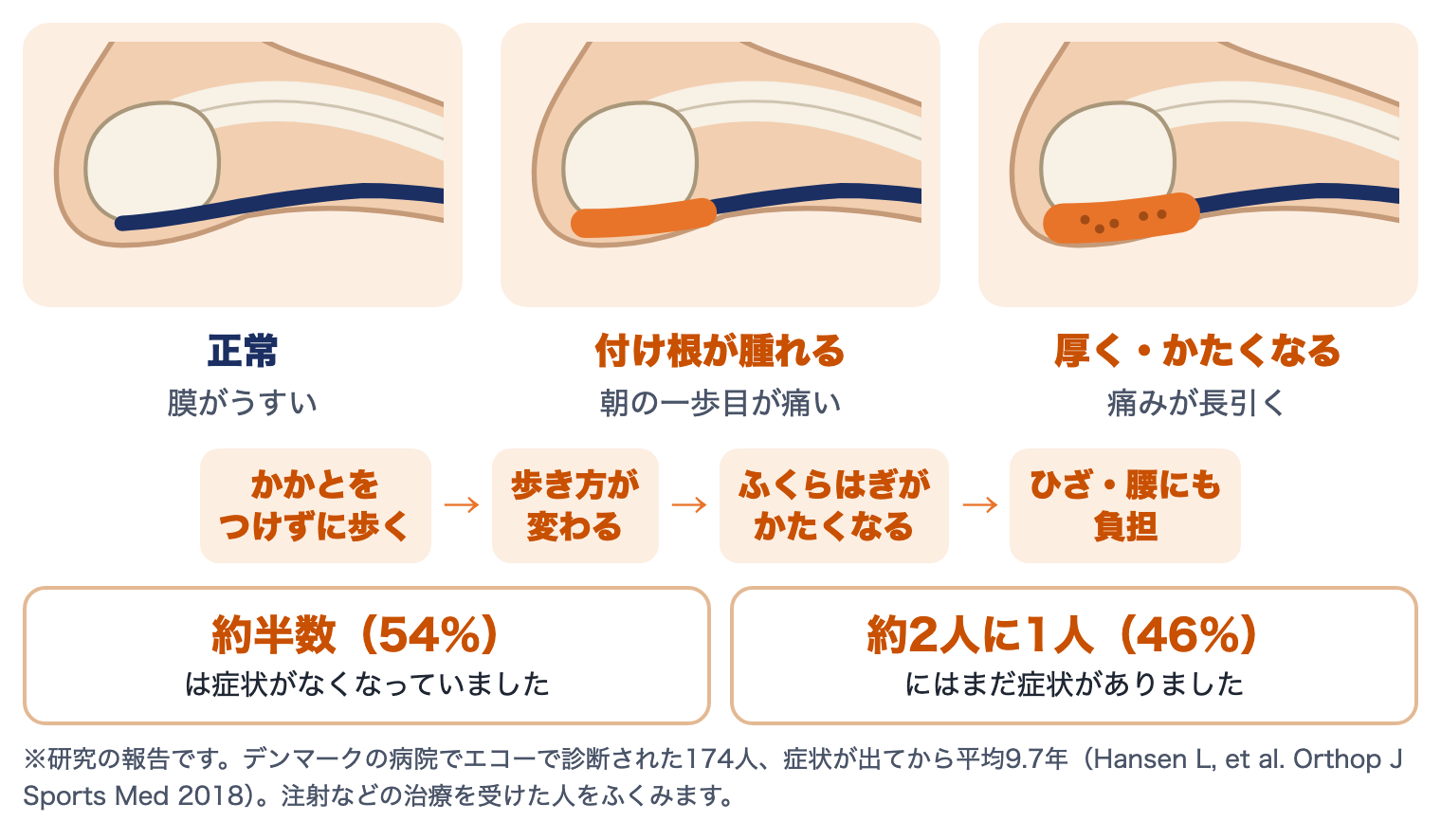 足底腱膜の痛みを放っておくと：正常、付け根が腫れる、厚く・かたくなるの3つの絵と、かかとをつけずに歩く・歩き方が変わる・ふくらはぎがかたくなる・ひざ・腰にも負担という流れ、約10年後に約半数は症状がなくなり約2人に1人にはまだ症状があったという研究