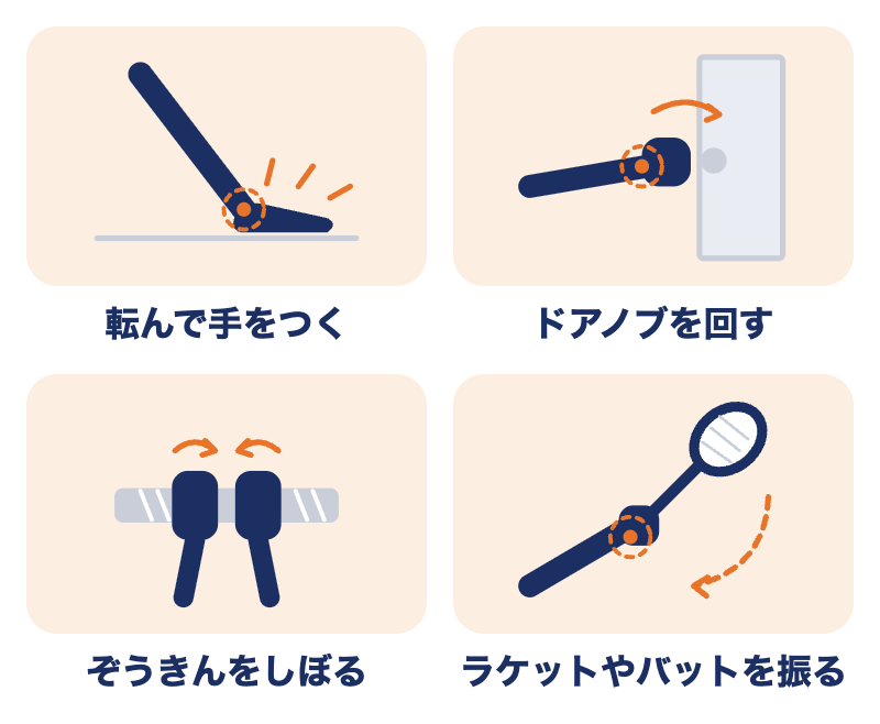 TFCC損傷で痛みやすい動き：転んで手をつく、ドアノブを回す、ぞうきんをしぼる、ラケットやバットを振る