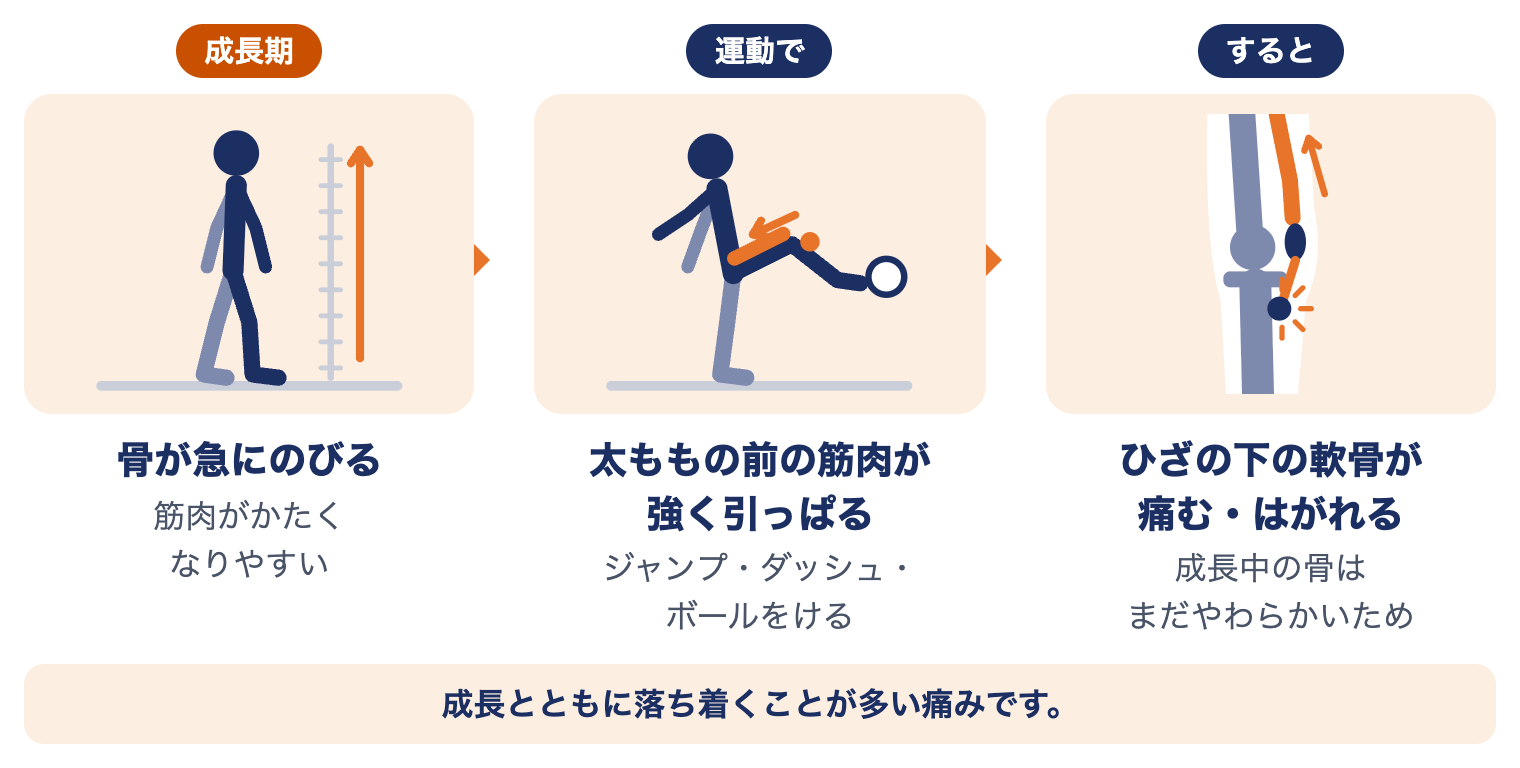 オスグッド病が起こるしくみ：成長期に骨が急にのびる、太ももの前の筋肉が強く引っぱる、ひざの下の軟骨が痛む・はがれる